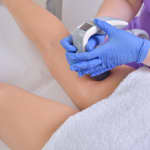 VelaShape III (3 sesiones) + Diagnóstico Corporal: Remodelación Total sin Cirugía