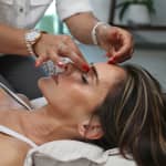 Dermapen