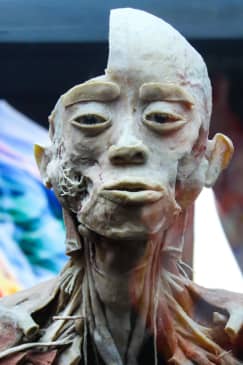 Bodies Evolution: Cuerpos humanos reales - Copiapó