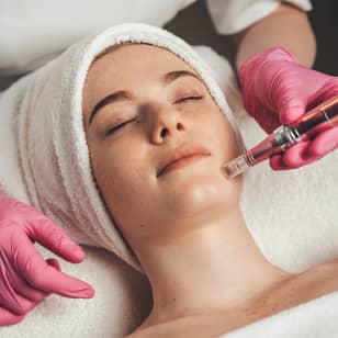 Dermapen en Madrid