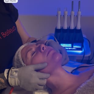 Biolifting mit Silberhandschuhen: Natürliche, Nadelfreie Verjüngung