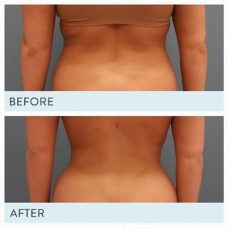Pro Define Body Sculpt: reduce, define y moldea en 30 minutos 4