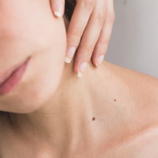 Peeling Treatment 1