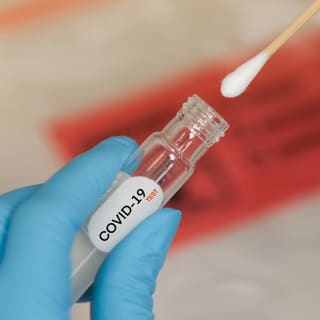 Test COVID-19: antígenos en la clínica Blue Healthcare 3