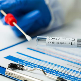 Test COVID-19: Antígenos, PCR y más en la clínica Blue Healthcare 1