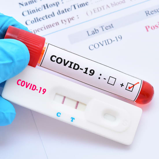 Test COVID-19: test rápido en la clínica Blue Healthcare