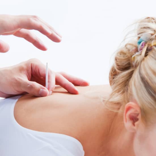 60 Minute Massage or Acupuncture Treatment - Fulton
